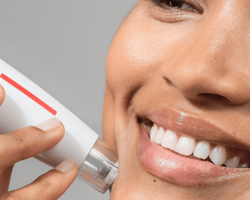 Microneedling