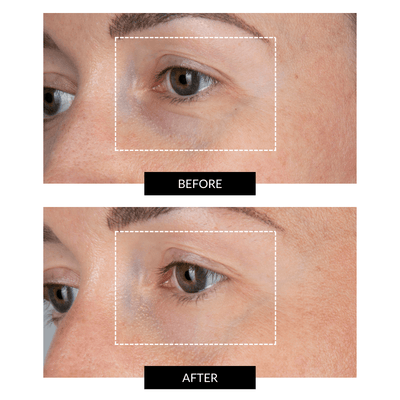 CurrentBody Skin LED Eye Perfector & 5 Eye Hydrogel Masks