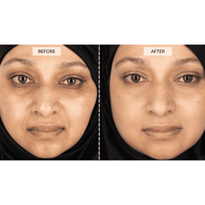 CurrentBody Skin LED 4-in-1 Zone Facial Mapping Mask