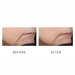 NuFACE Trinity Facial Toning Device Before and After Review